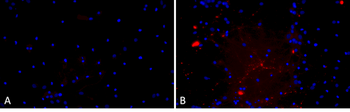 Alpha Synuclein A53T Mutant Pr