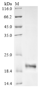 重组蛋白 Human Urocortin-2 (UCN2),