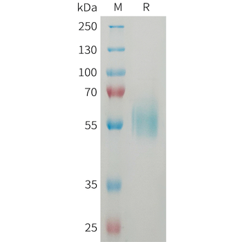Human CEACAM5(35-144) Protein蛋