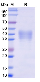 Monkeypox virus/MPXV E8L 重组蛋白，