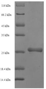 Bacterial scn Protein蛋白，orb358