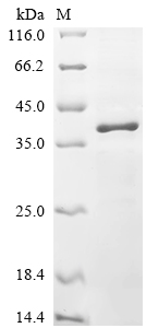重组蛋白 Human B-cell CLL/lymphoma