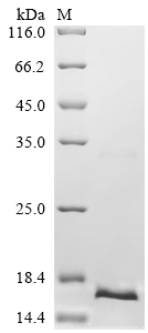 重组蛋白 Human DNA-directed RNA po