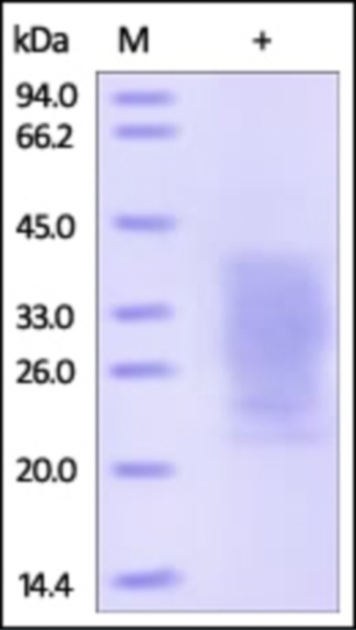 PTHR1 重组蛋白，orb1227904，biorbyt