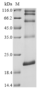 Mouse Ninj1 Protein蛋白,orb14771