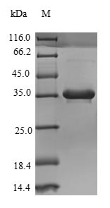Human C4B Protein蛋白，orb246048，