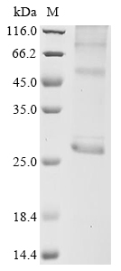 Human AQP5 Protein蛋白,orb147785