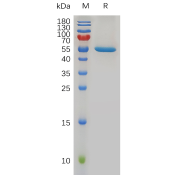 Human CCR2 Protein蛋白, mFc Tag,