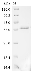 重组蛋白 Human B-lymphocyte antige