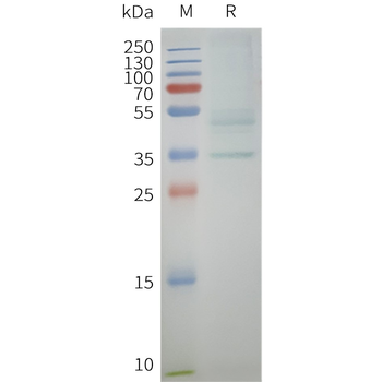 Human CCR10 full length Protei