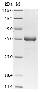 Human HPRT1 Protein蛋白，orb14774