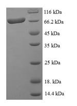 Human ARHGAP19 Protein蛋白，orb24