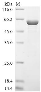 重组蛋白 Human Galectin-3-binding 
