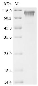 重组蛋白 Human metapneumovirus Maj
