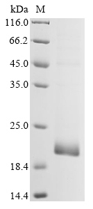 Human coronavirus 229E Membran
