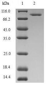 Human MTHFR Protein蛋白,orb24639