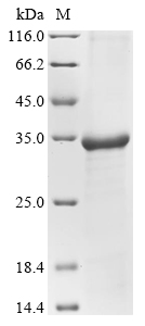 Human HPRT1 Protein蛋白，orb14774
