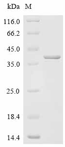 重组蛋白 Bordetella pertussis Pert
