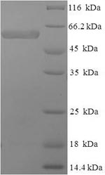 Human SMARCB1 Protein蛋白，orb244