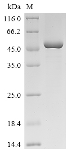 重组蛋白 Human Melanoma-associated