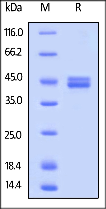IL12 B 重组蛋白，orb1227944，biorbyt