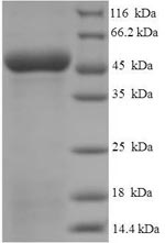Human CD1D Protein蛋白，orb244083