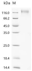 重组蛋白 Epstein-Barr virus envelo