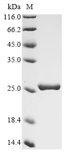 esxC Protein蛋白，orb1477069，bior