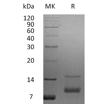 Human IGHE Protein蛋白, His Tag，