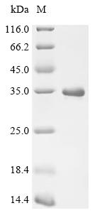 重组蛋白 Macaca mulatta Prostate-s