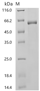 重组蛋白 Human E3 ubiquitin-protei