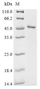 重组蛋白 Human S-adenosylmethionin