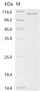 重组蛋白 Human Importin subunit be