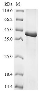重组蛋白 Hordeum vulgare Gamma-hor