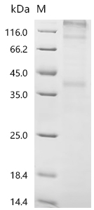 重组蛋白 Human C-C chemokine recep