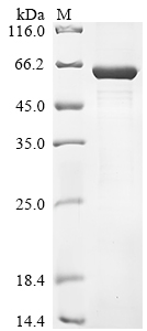 重组蛋白 Human Lactase-like Protei
