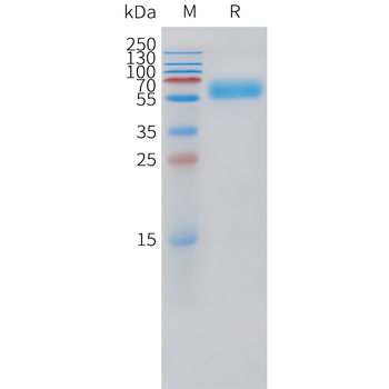 Feline IL31 Protein蛋白, His Tag