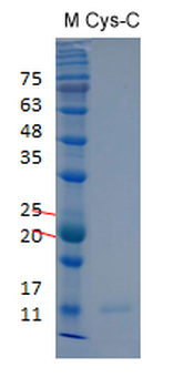 重组蛋白 human Cystatin-C Protein蛋