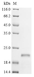 重组蛋白 Human immunodeficiency vi