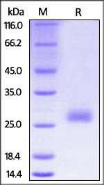 CTLA-4 重组蛋白，orb1227690，biorbyt