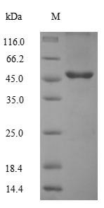 Human TMEM25 Protein蛋白，orb2445