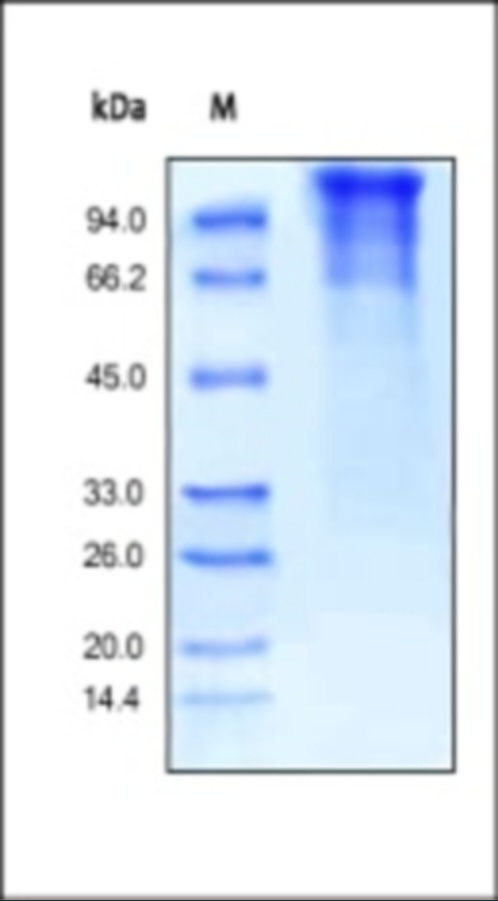 LDLR 重组蛋白，orb1227968，biorbyt