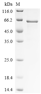 重组蛋白 Human MAP kinase-interact