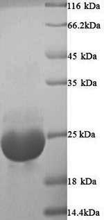 Yeast OV16 Protein蛋白，orb246084