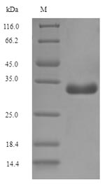 E. coli F17a-A Protein蛋白，orb35