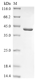 重组蛋白 Human Ceroid-lipofuscinos