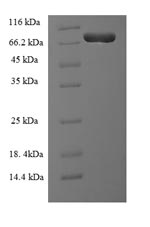 Human LCP1 Protein蛋白，orb246756