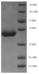 Monkey EPO Protein蛋白,orb358362