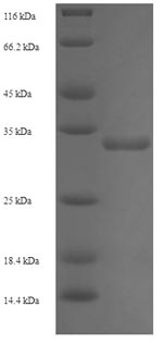 Human TXNDC12 Protein蛋白，orb246