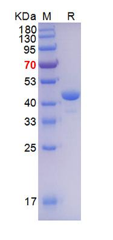 重组蛋白 human Lamin A/C Protein蛋白